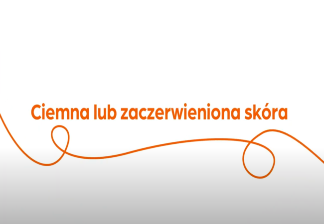 Tekst „Ciemna lub zaczerwieniona skóra" z pomarańczową spiralą na białym tle.